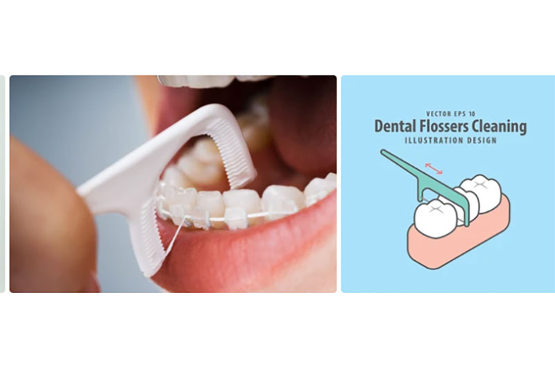 FLOSS PICK